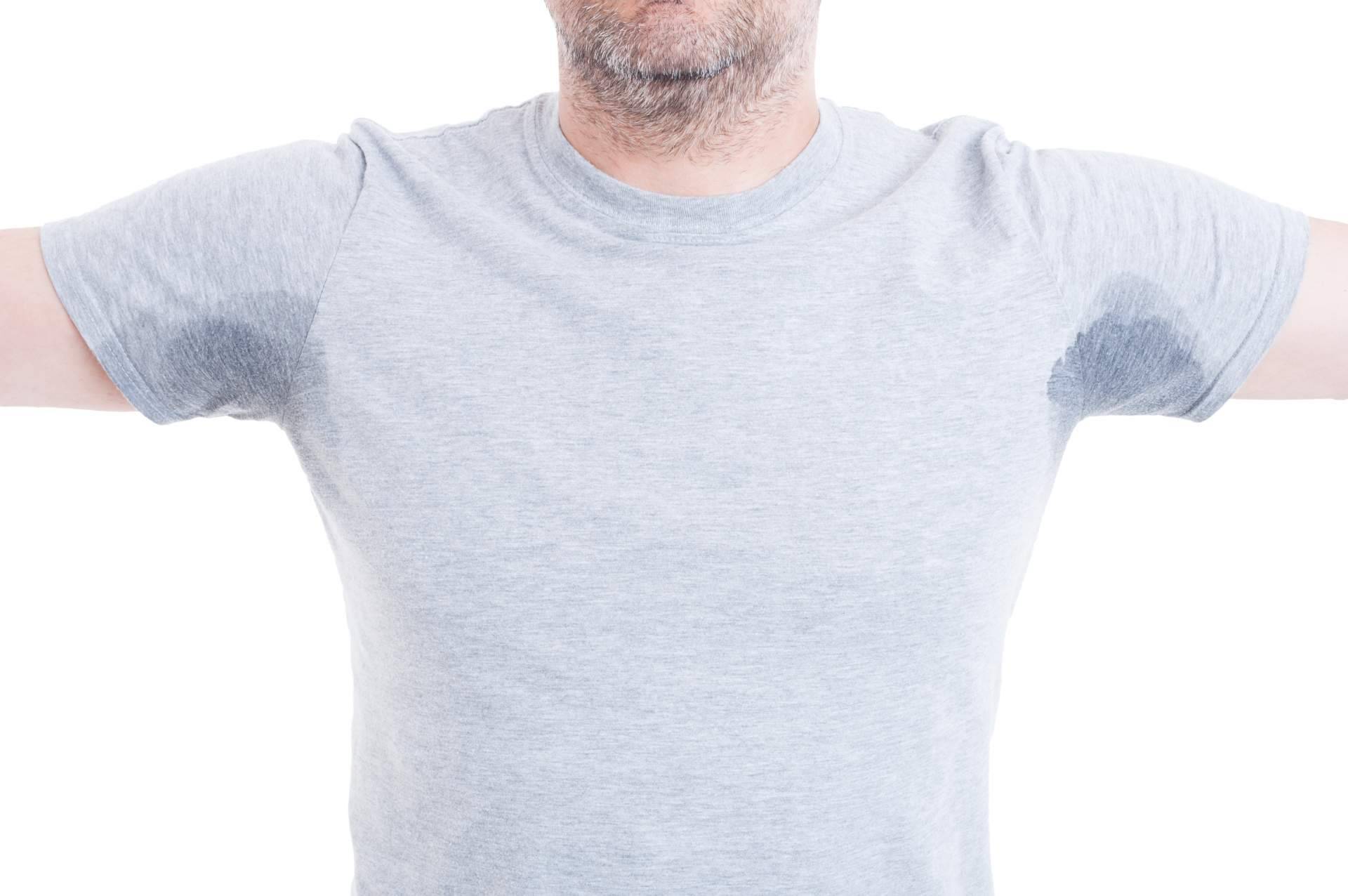 Hiperhidrosis: la forma segura de tratar la sudoración excesiva en Clínica Fercasy