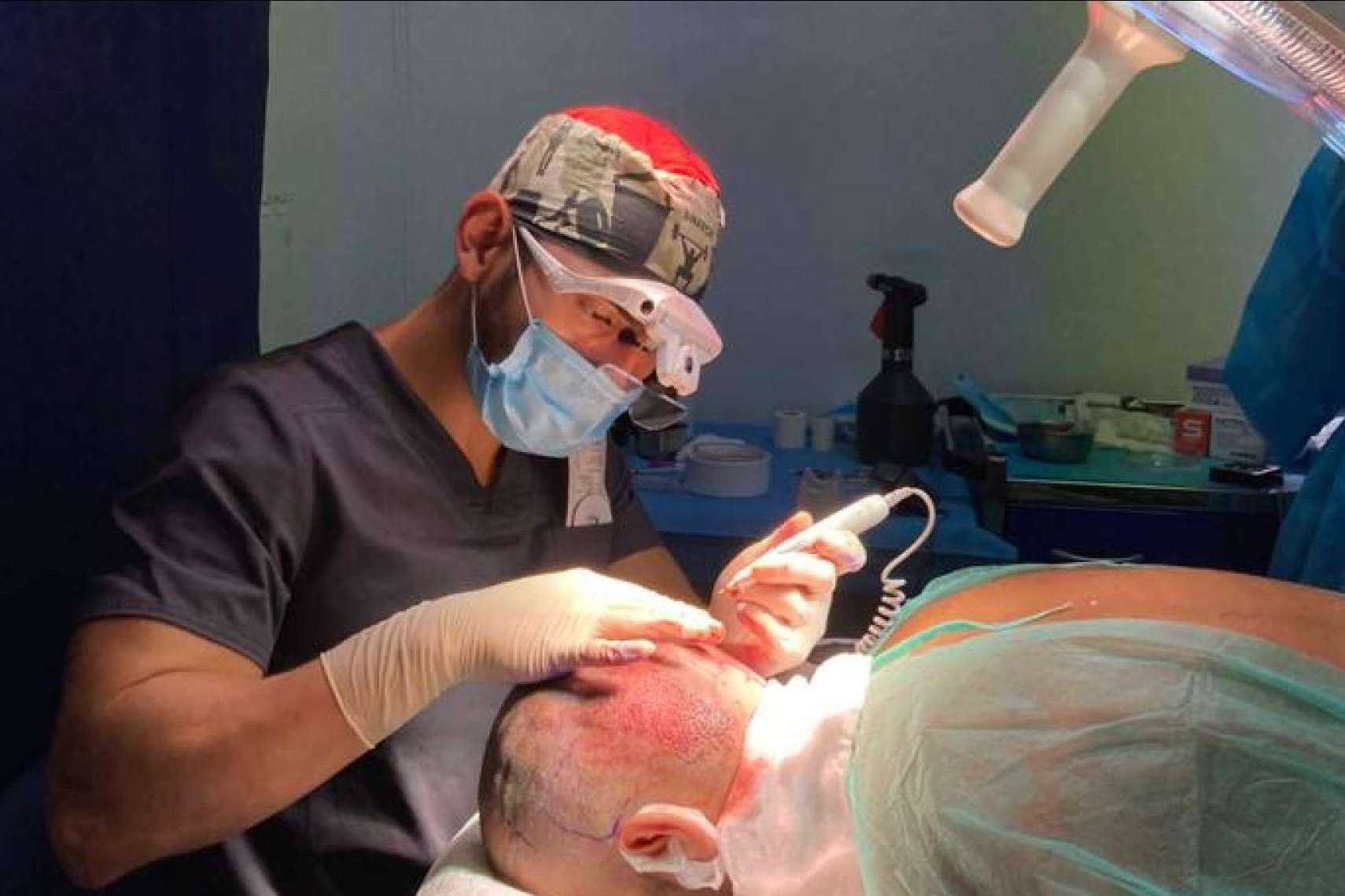 ¿A qué edad se recomienda realizar un injerto capilar?, por Doctor Bern