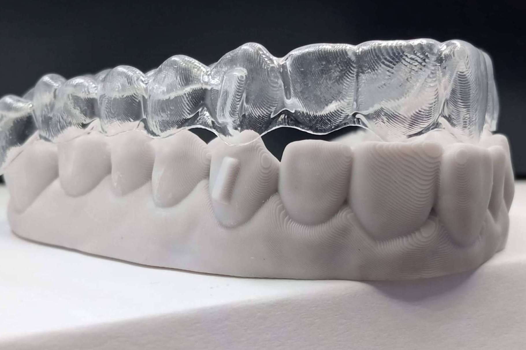 ¿Por qué elegir Smile Aligner como ortodoncia invisible?