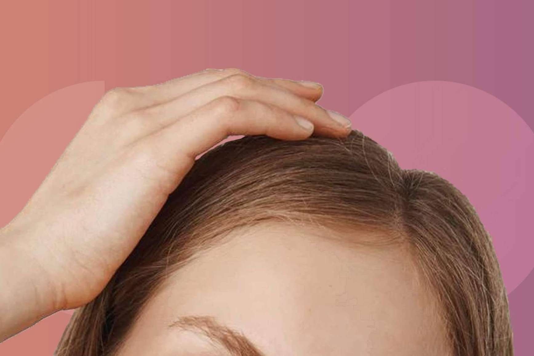 Este año la caída de cabello estacional viene más fuerte