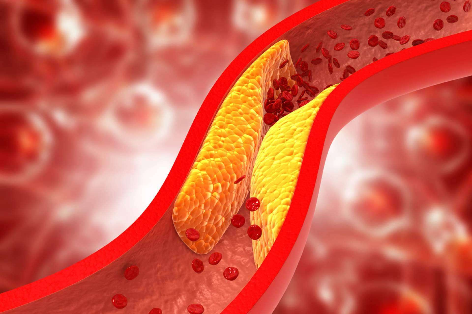 ReduCol 25, la fórmula innovadora con levadura roja de arroz rojo de Beverly Nutrition