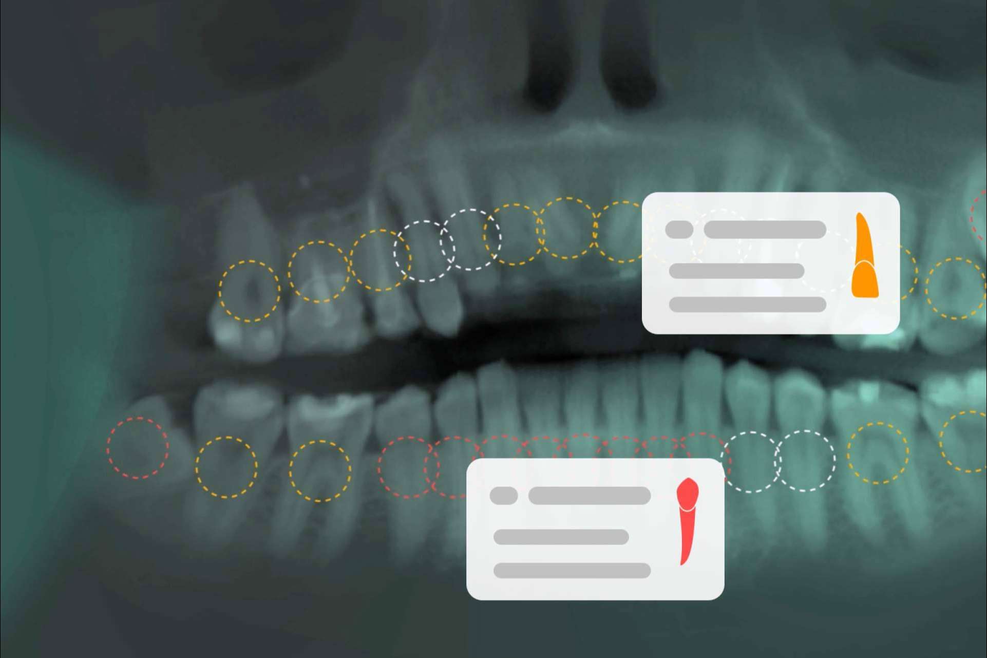 La inteligencia artificial llega en el ámbito de la odontología con Dentomo