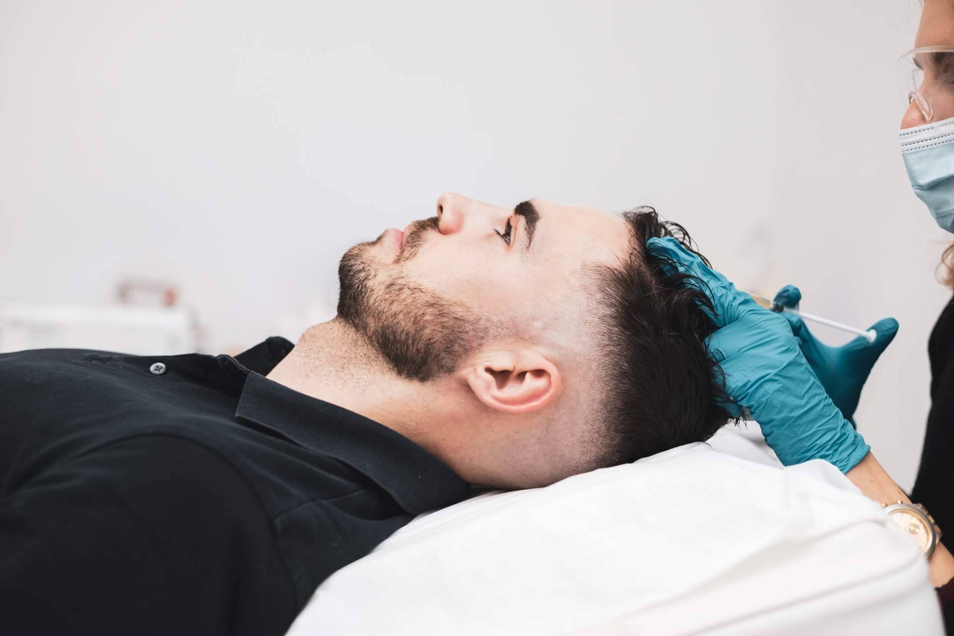Tratamientos de injerto capilar en Madrid con el Doctor Jesús Aníbal Mora en Capilar Innovation Clinic
