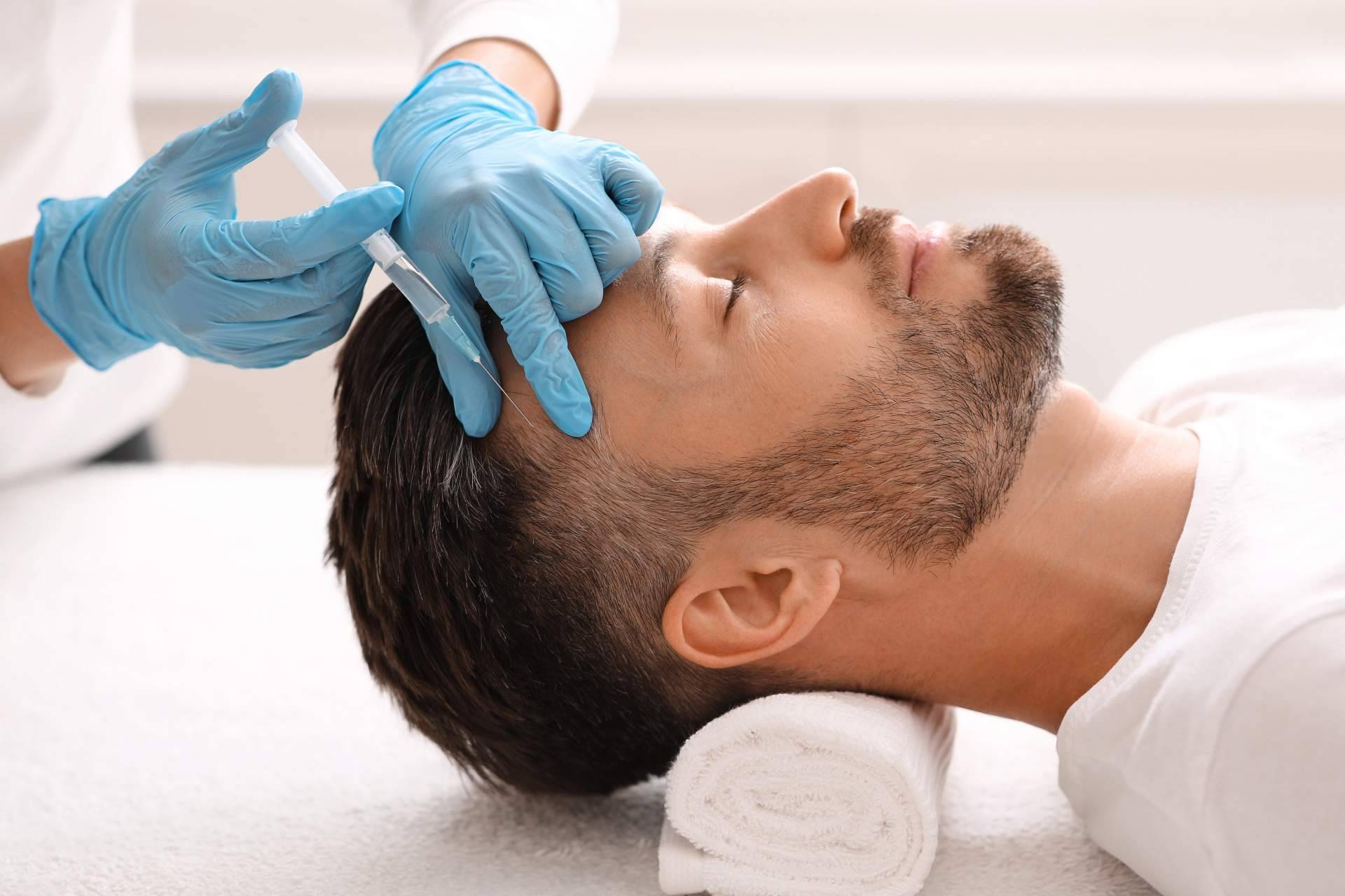 Tratamiento de la alopecia androgenética con exosomas, de la mano de Alluring Clinic