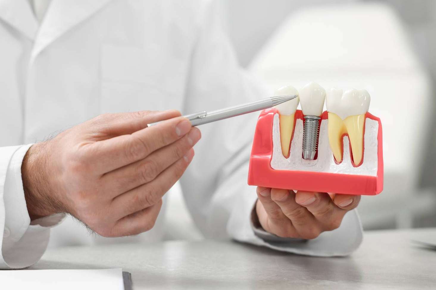 Tratamientos Periodontales; Cómo mejorar la salud de las encías