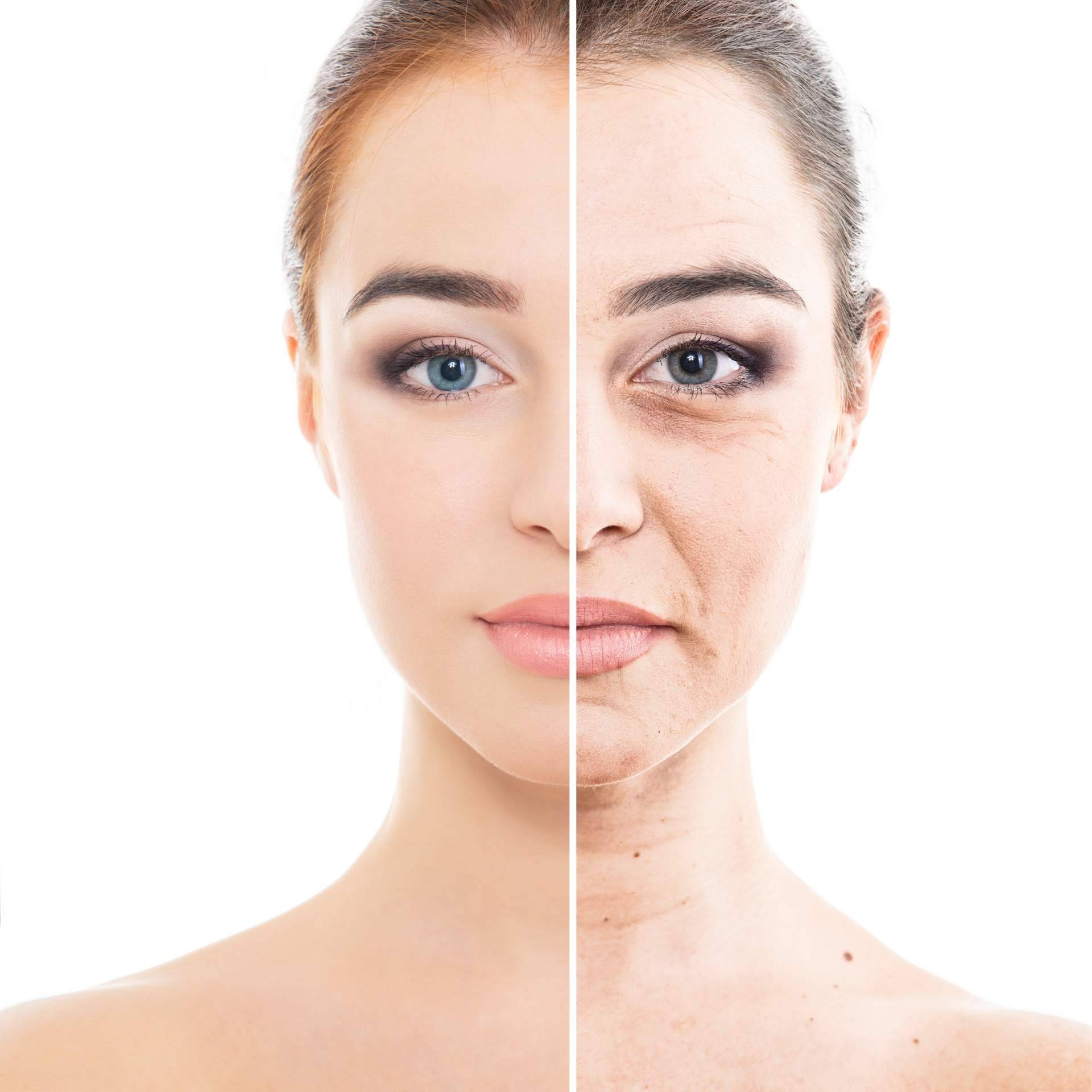 Corrección de las ojeras en Centro Estética El Pilar