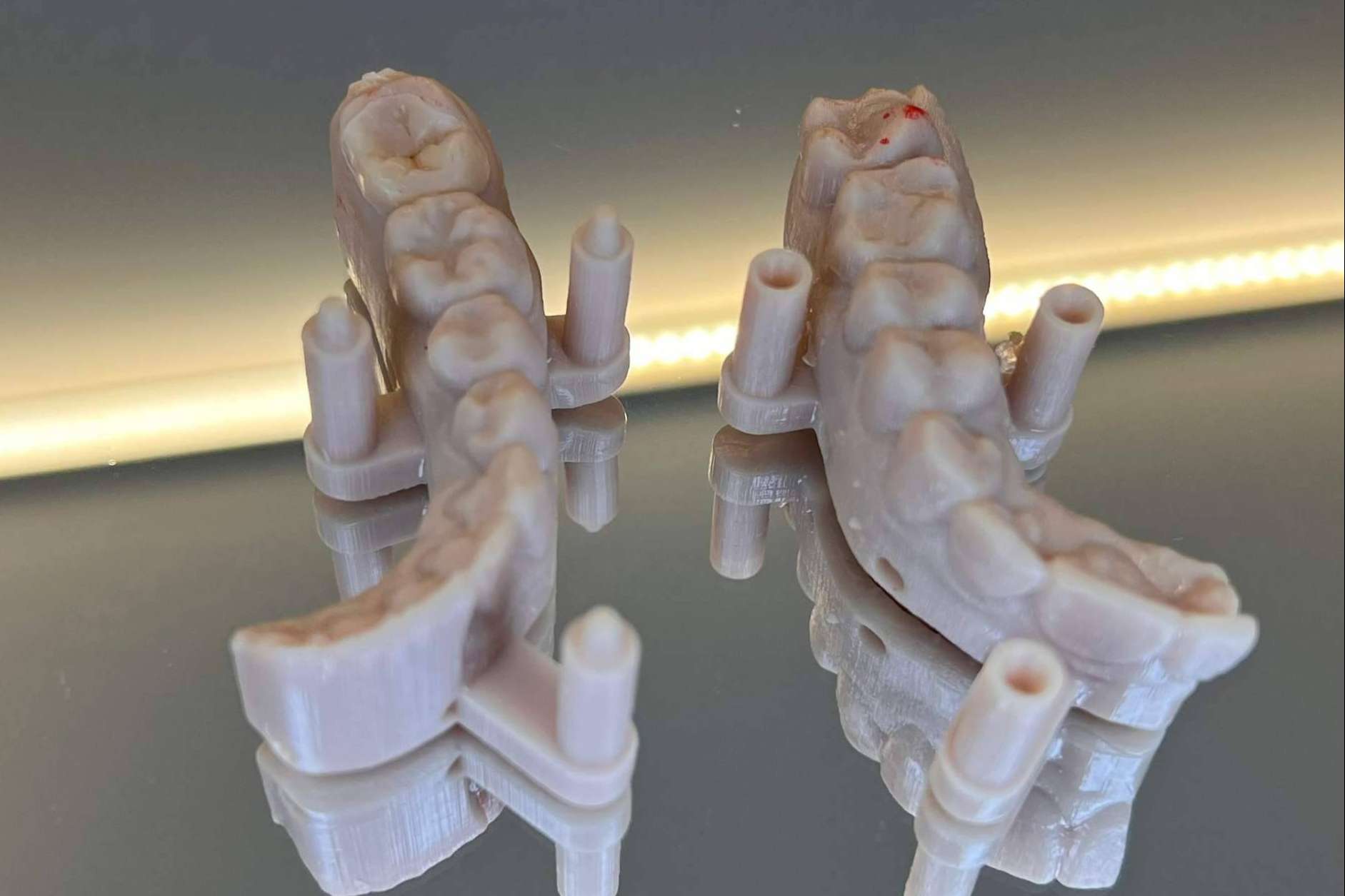 Tecnología avanzada 3D para una sonrisa perfecta en una visita, con Dentinova