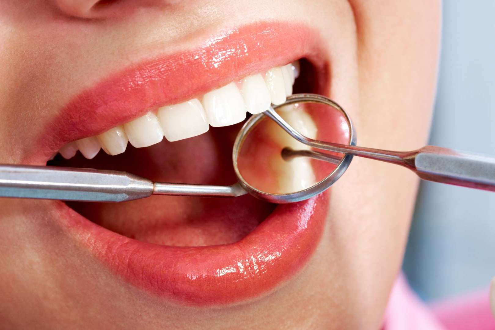 Los implantes dentales, inversión clave para la salud bucodental y estética, con precios que varían según múltiples factores