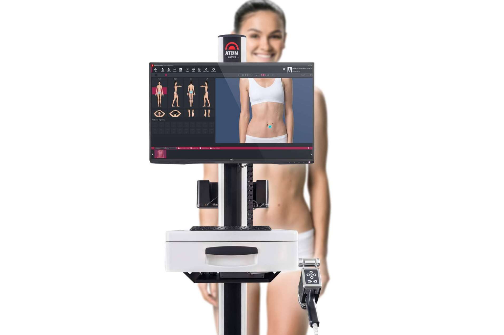 La tecnología con Inteligencia Artificial de FotoFinder mejora los flujos de trabajo de los dermatólogos
