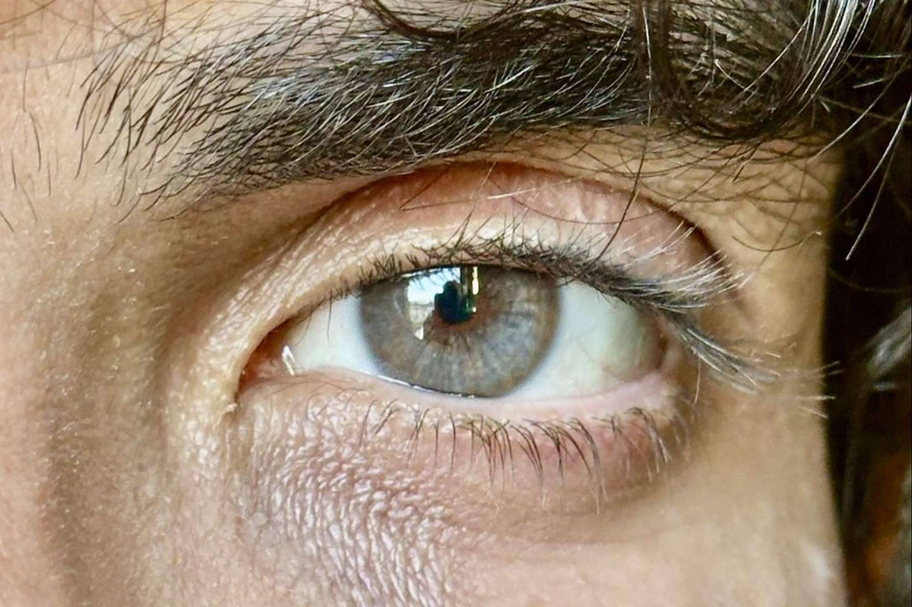 El color de ojos puede cambiarse con el tratamiento de Eyecos