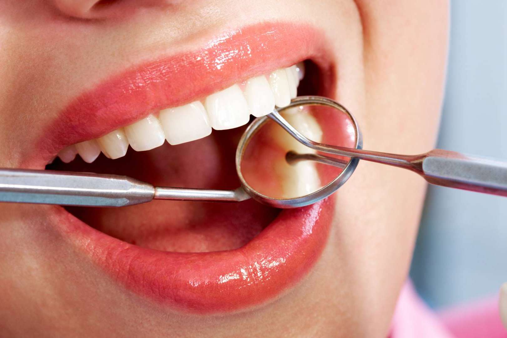 Tratamiento para la periodontitis; en qué consiste y cuánto cuesta