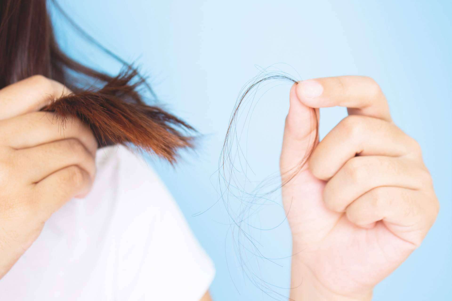 Cómo saber si se tiene alopecia