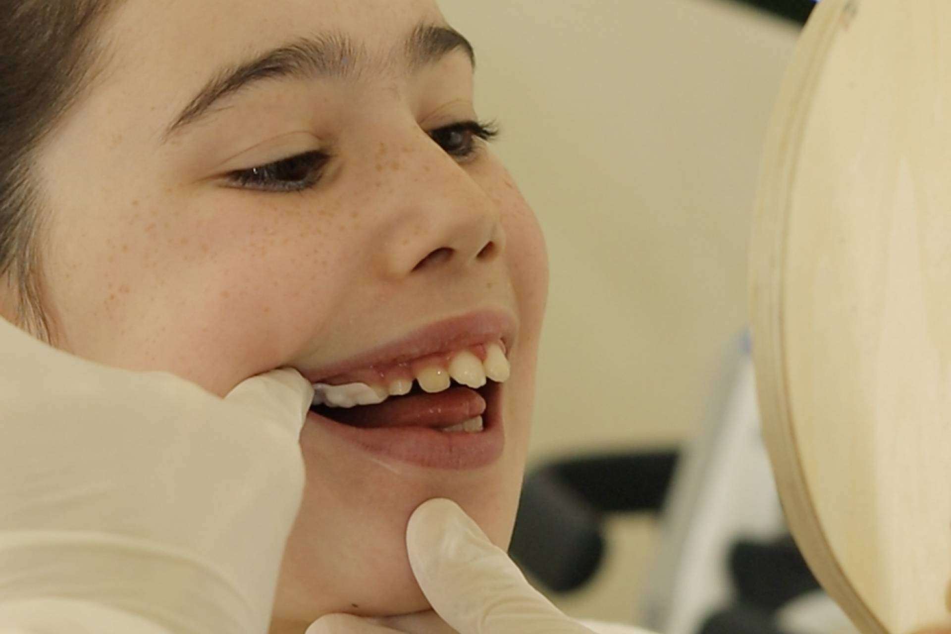 Smart Aligner Services da la bienvenida al Palatal Expander en su evento ‘Expansión Dental y esquelética’