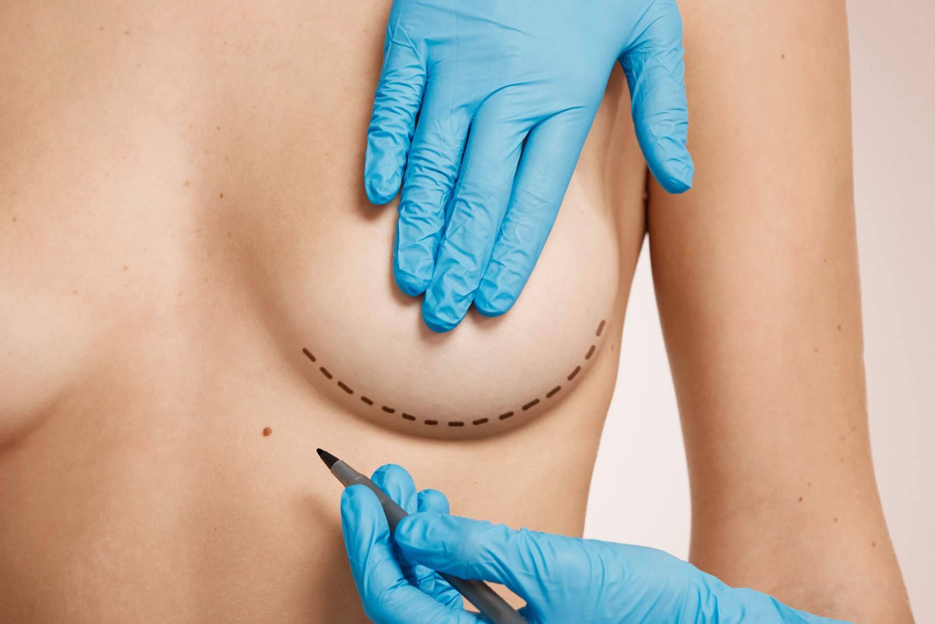 Beauty & Beauty amplía sus servicios de cirugía estética en Andalucía y Canarias