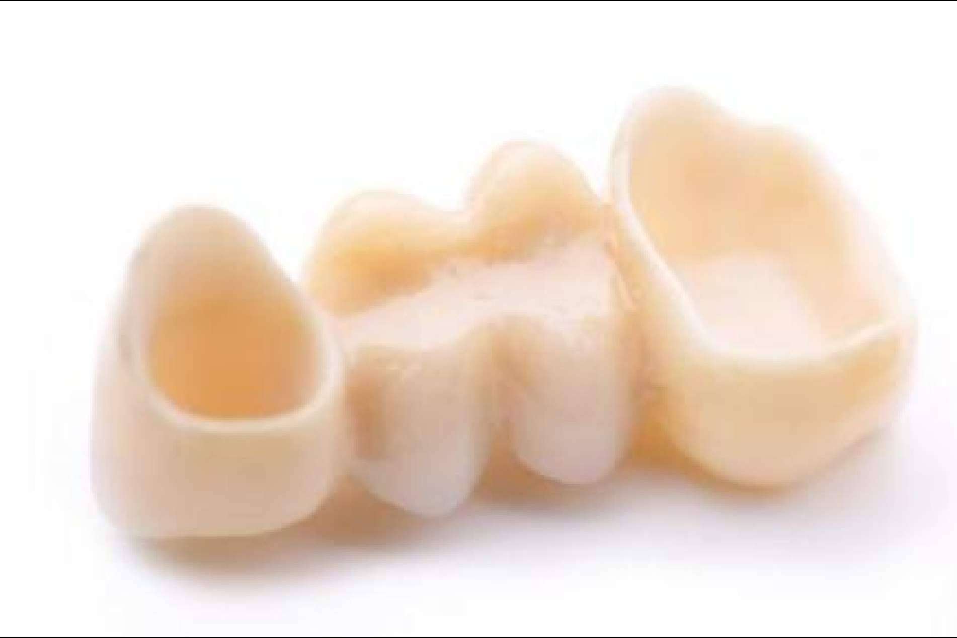 Prótesis fija estética de zirconio; la apuesta de Clínica Dental Jorge del Corral por la calidad y la estética dental