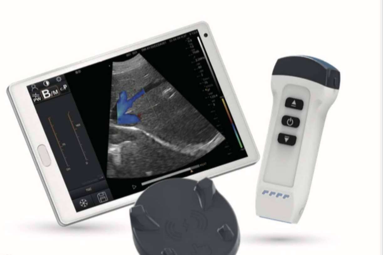 SCPmedical anuncia su representación oficial en España de los ecógrafos inalámbricos Dawei, líderes en ligereza y calidad de imagen
