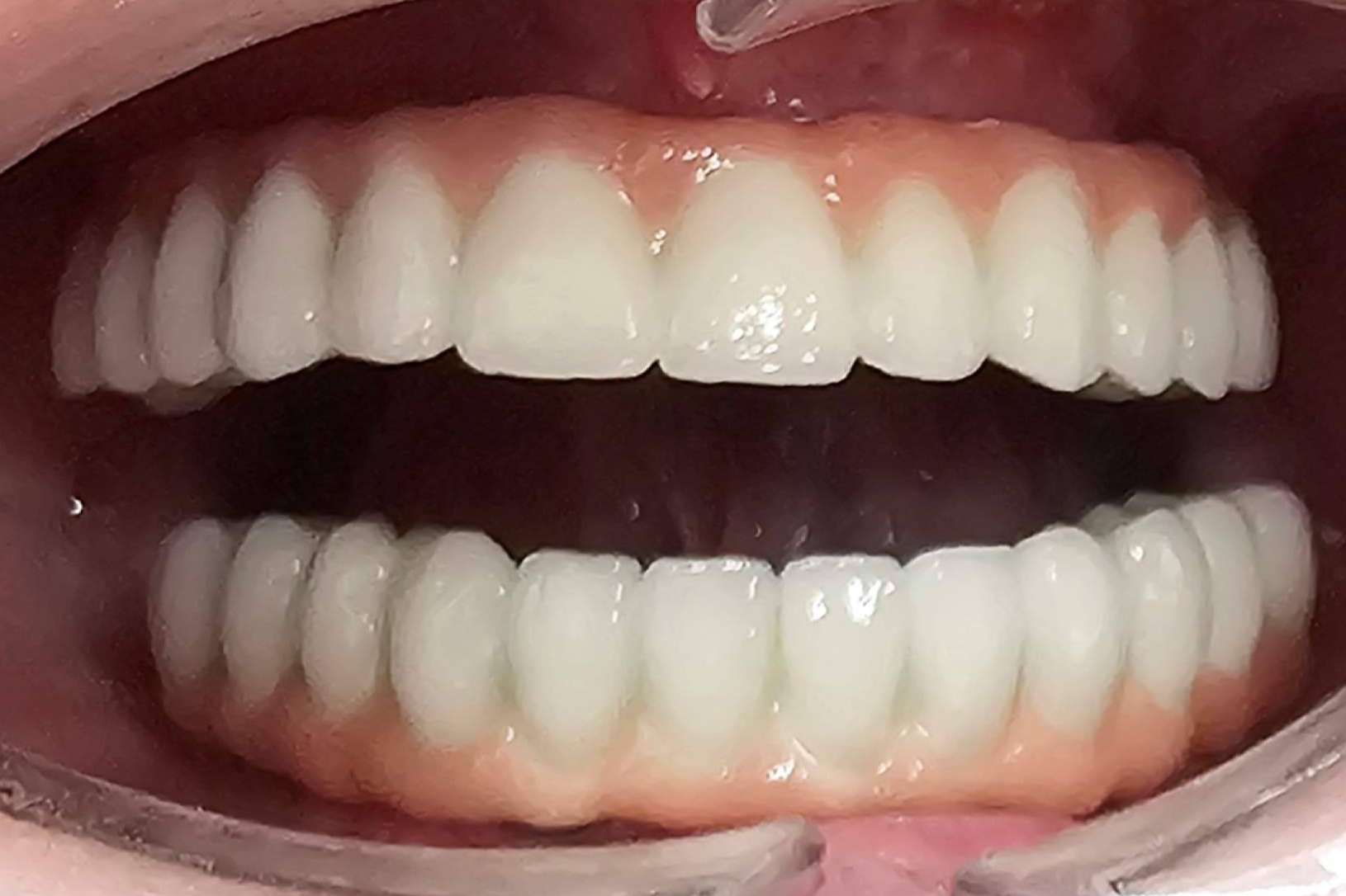 5 consejos antes de elegir una clínica dental. Cómo elegir al mejor cirujano