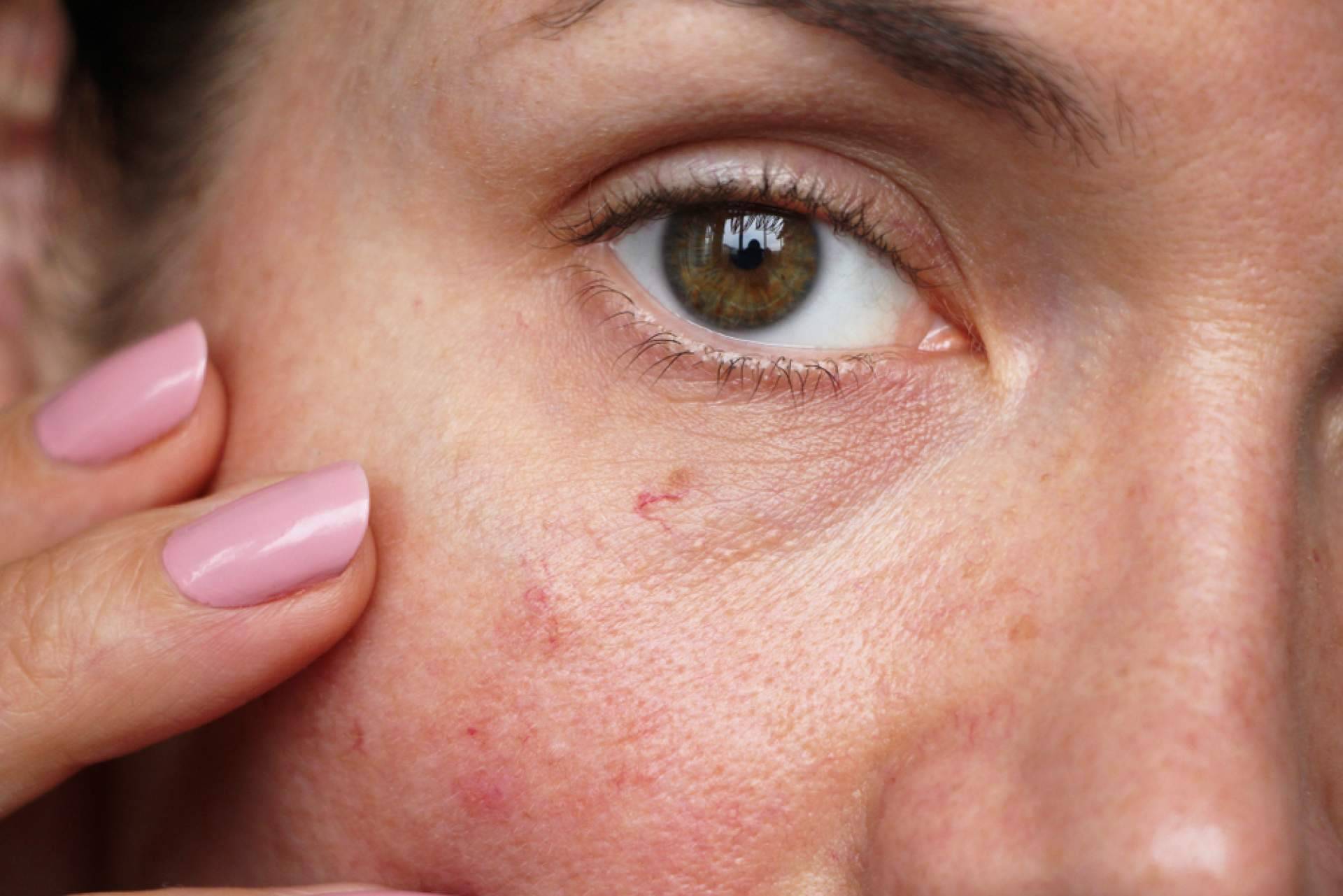 Evoderm; innovación en dermocosmética con respaldo de expertos y fórmulas limpias